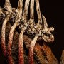 Odogaron Deluxe